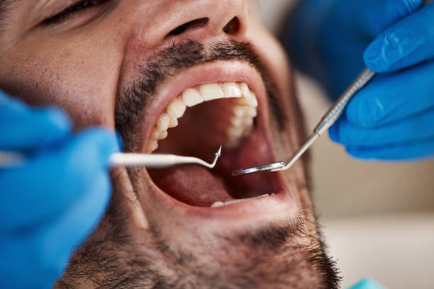 Best Root Canal Treatment  in Cleary, MS